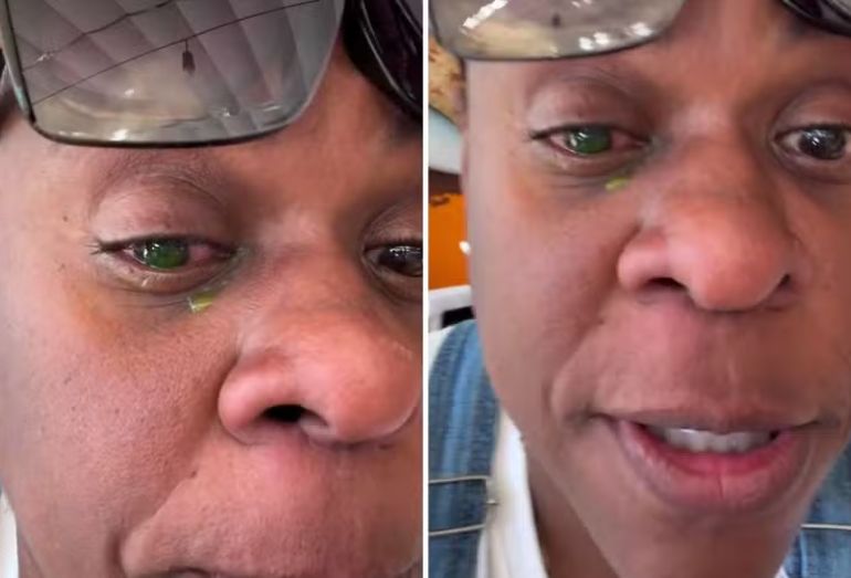 Print do vídeo de Cacau Protásio nos Stories, usando óculos escuros e relatando o problema na visão; ou foto da atriz caracterizada para o filme "Os Farofeiros 3".